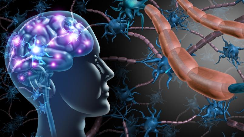 Sclérose en plaques: quand le système immunitaire attaque le système nerveux Sclérose en plaques: quand le système immunitaire attaque le système nerveux