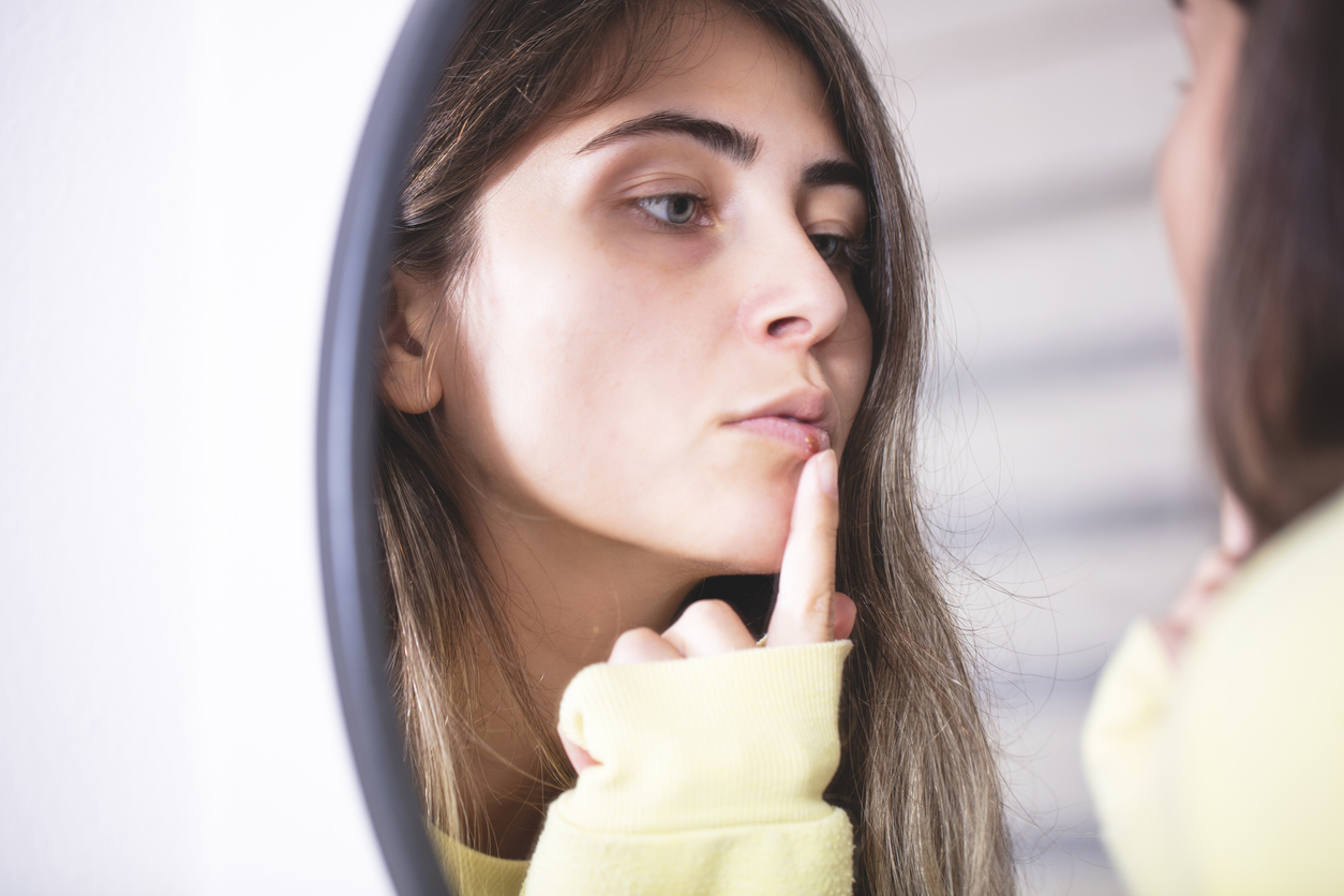 Bouton de fièvre, comment le soigner ? Bouton de fièvre, comment le soigner ?